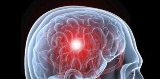 Medidas preventivas para evitar complicaciones en Enfermedad Vascular Cerebral.