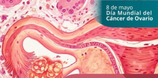 Conmemora la Secretaría de Salud el Día Mundial del Cáncer de Ovario