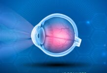 Secretaría de Salud de Querétaro promueve la detección temprana del glaucoma