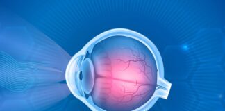 Secretaría de Salud de Querétaro promueve la detección temprana del glaucoma