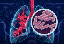 La Secretaría de Salud se une a la conmemoración del Día Mundial de la Tuberculosis