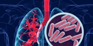 La Secretaría de Salud se une a la conmemoración del Día Mundial de la Tuberculosis