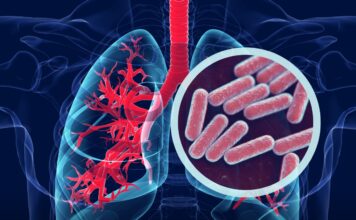 La Secretaría de Salud se une a la conmemoración del Día Mundial de la Tuberculosis