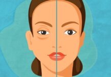 La Secretaría de Salud se suma al Día Mundial del Angioedema Hereditario
