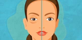 La Secretaría de Salud se suma al Día Mundial del Angioedema Hereditario