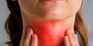 Diagnóstico oportuno y tratamiento precoz, claves para enfrentar el cáncer de cabeza y cuello