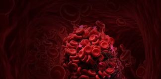 La Secretaría de Salud Conmemora el Día Mundial de la Trombosis y promueve medidas de prevención